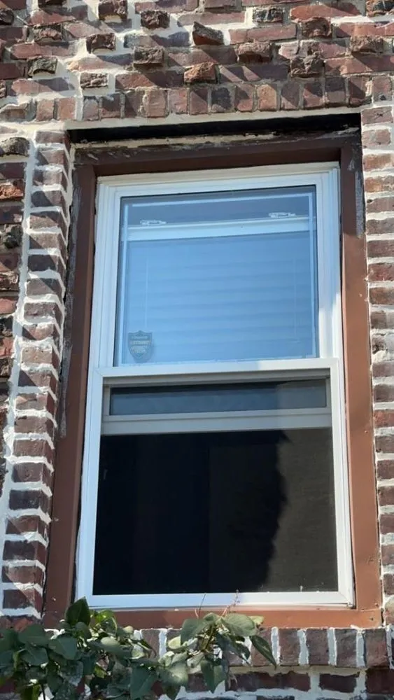 Slide of A1 Colgate Restoration