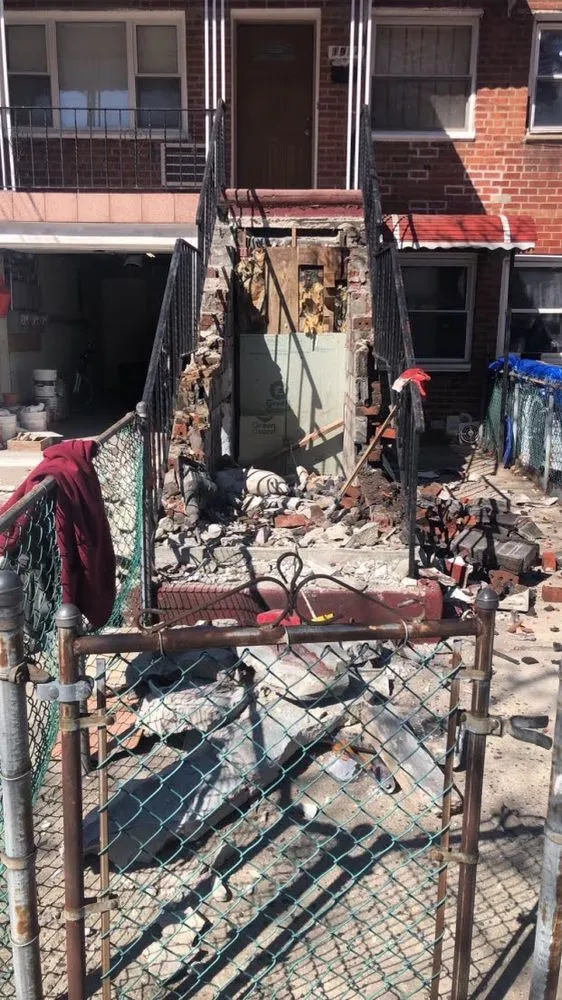 Slide of A1 Colgate Restoration