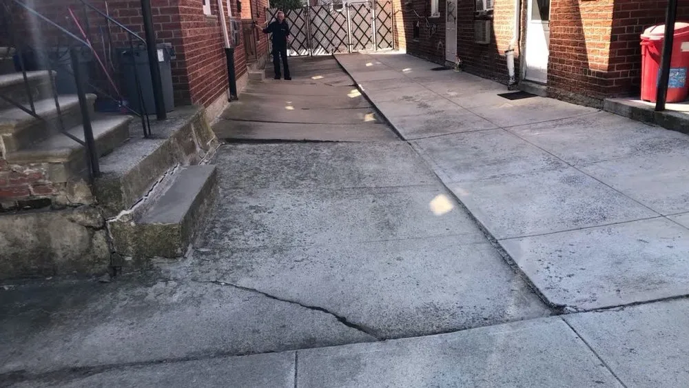 Slide of A1 Colgate Restoration