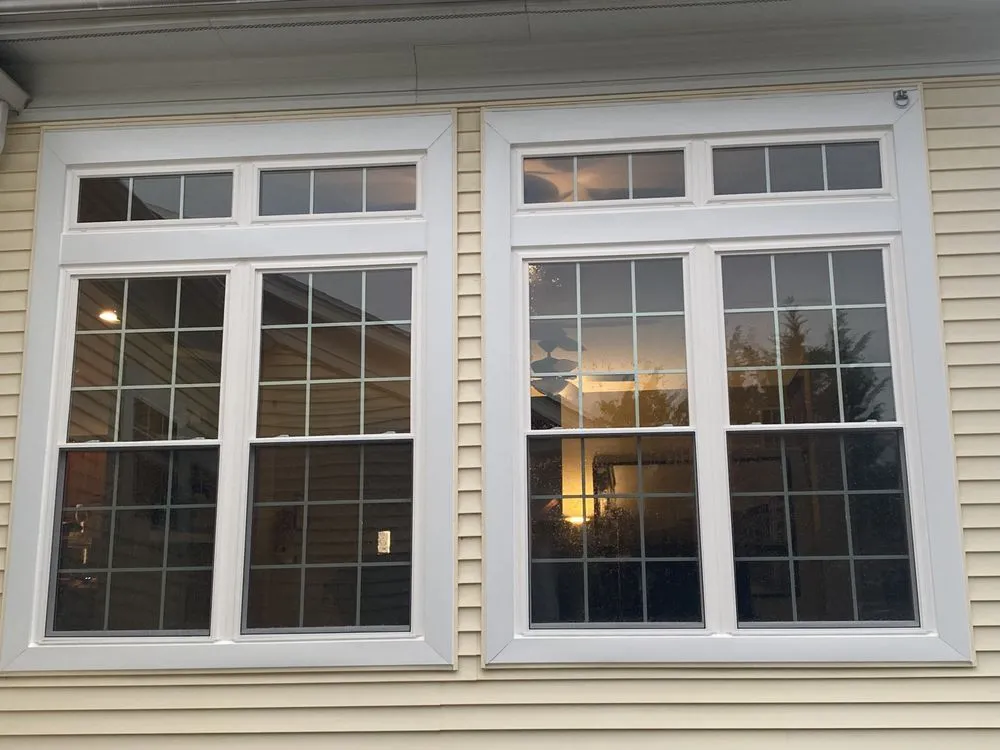 Slide of Anchor Remodeling