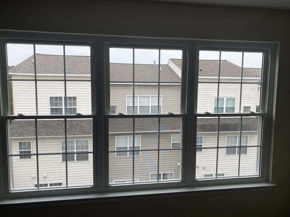 Slide of Anchor Remodeling