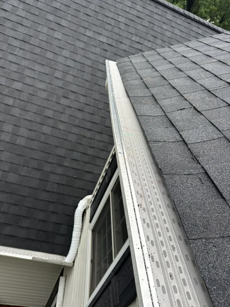 Slide of Anchor Remodeling