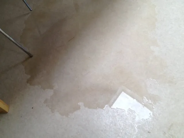 Slide of Benedictus Contracting