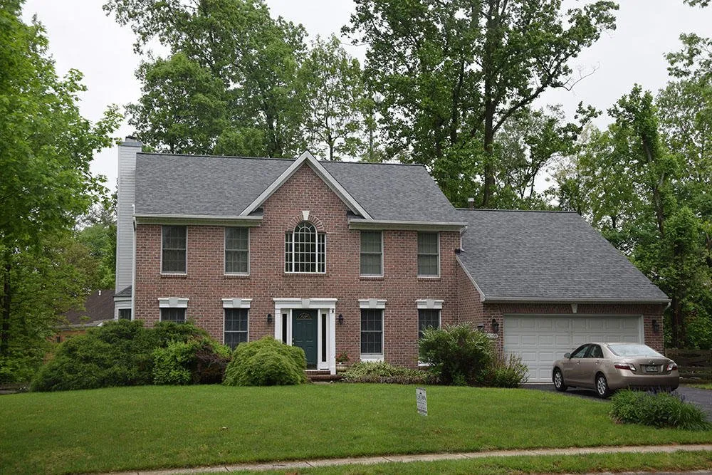 Slide of Crown Remodeling