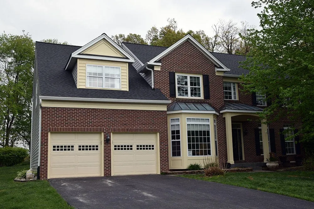 Slide of Crown Remodeling