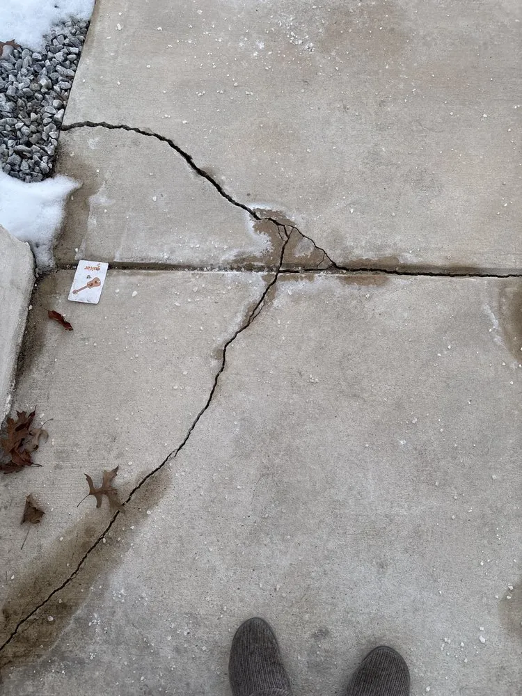 Slide of Grs contracting