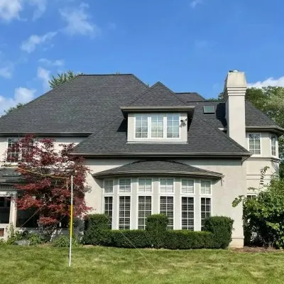 Slide of JAP Restorations