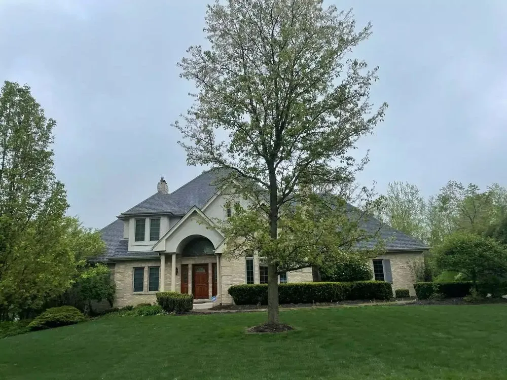 Slide of JAP Restorations