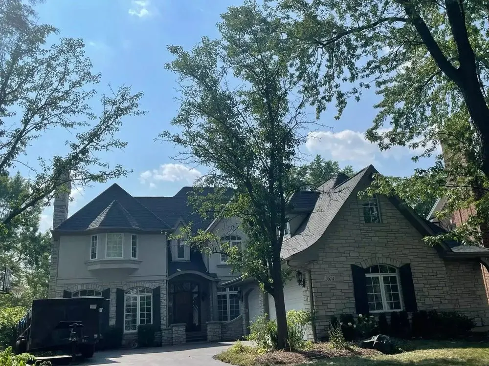 Slide of JAP Restorations