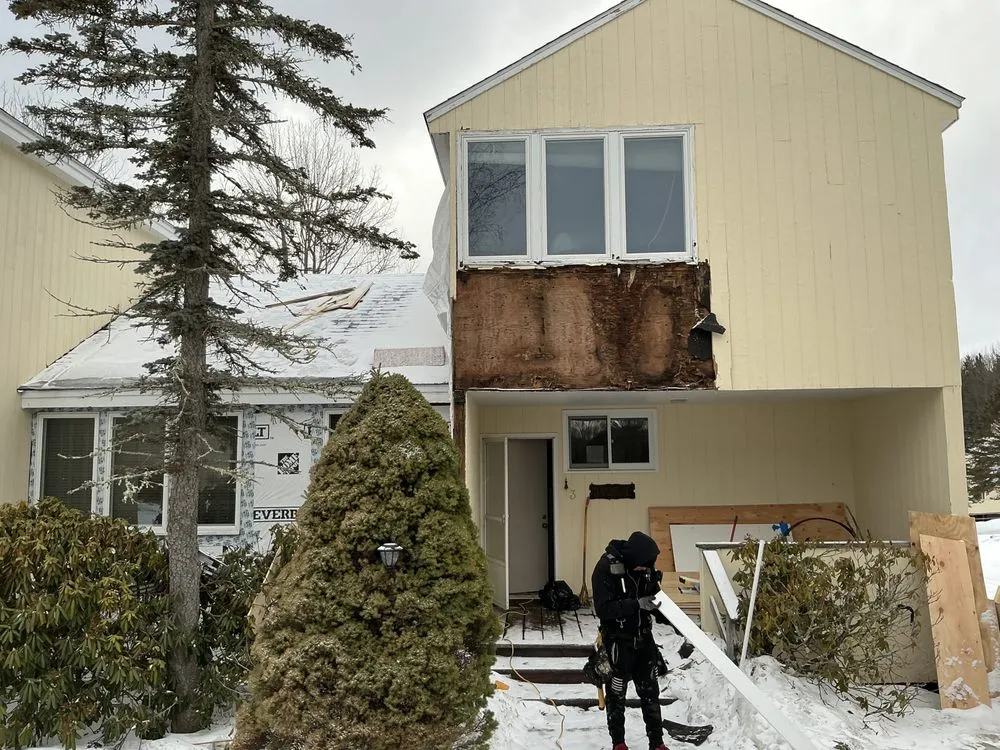 Slide of L-Pro Restoration