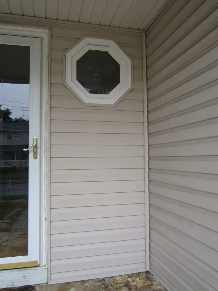 Slide of Matrix Remodeling