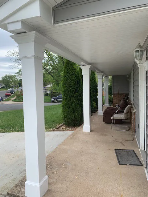 Slide of MDM Restoration