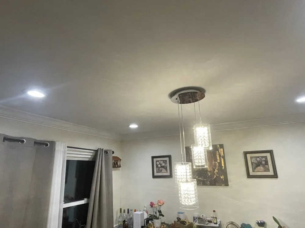 Slide of MDM Restoration