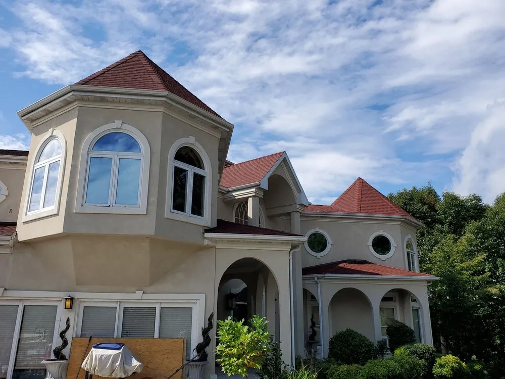 Slide of Mo Shingles