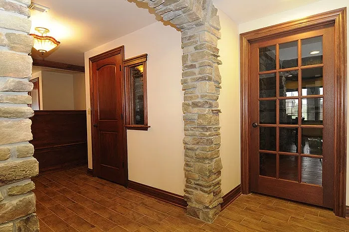 Slide of Noble Restorations