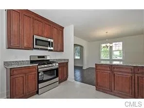 Slide of Ridge Remodeling