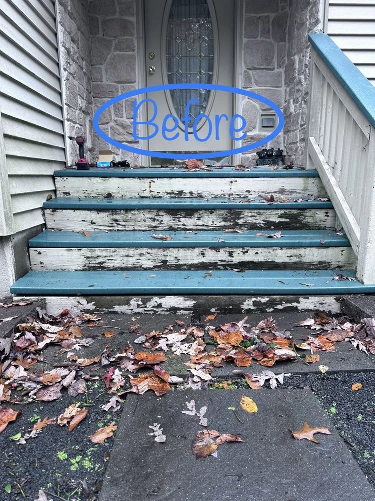 Slide of RIng Shank Contracting